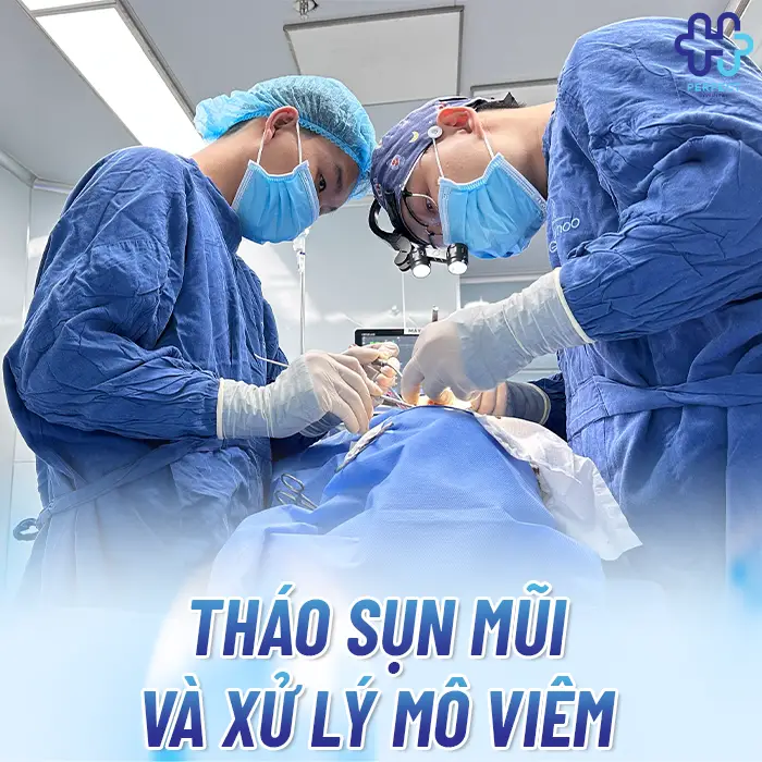 Nâng Mũi Không Hợp Sụn Là Gì Và Dấu Hiệu Nhận Biết Sớm