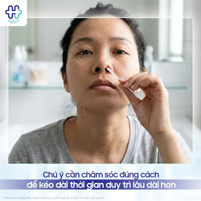 Nâng Mũi Không Phẫu Thuật Được Bao Lâu? Có Lâu Dài Không?