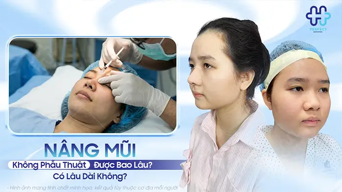 Nâng Mũi Không Phẫu Thuật Được Bao Lâu? Có Lâu Dài Không?