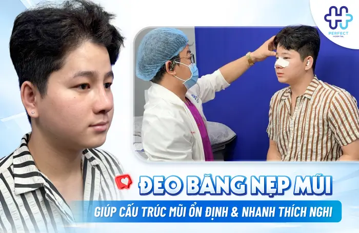 Nâng Mũi Mấy Ngày Tháo Băng? Mốc Thời Gian Hồi Phục Chuẩn