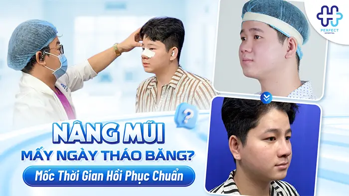 Nâng Mũi Mấy Ngày Tháo Băng? Mốc Thời Gian Hồi Phục Chuẩn