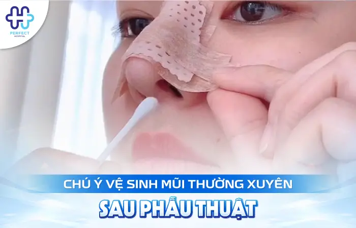 Nâng Mũi Kiêng Thịt Bò Bao Lâu? Thời Điểm Ăn Lại An Toàn