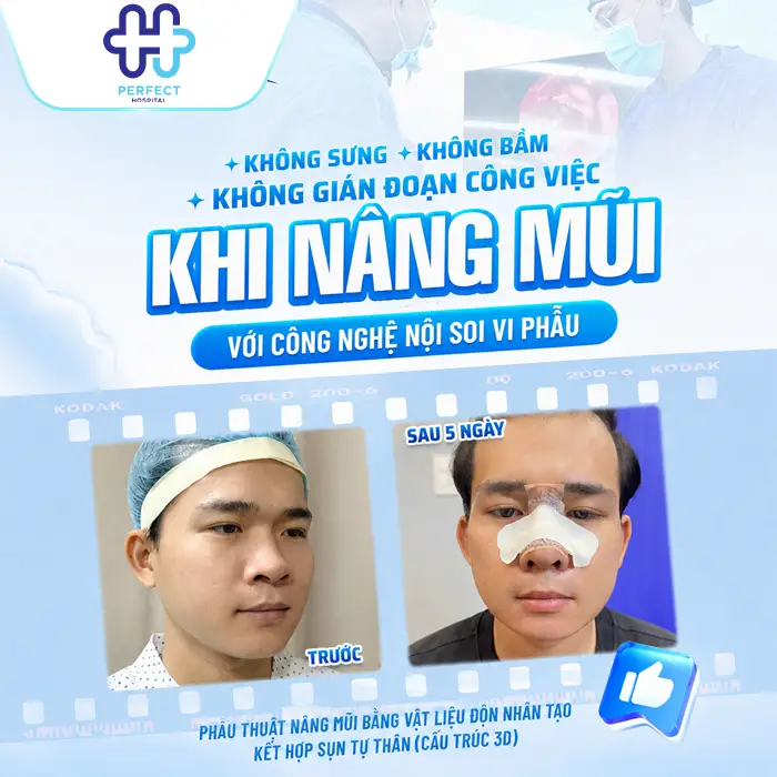 Nâng Mũi Nghỉ Dưỡng Bao Lâu? Khi Nào Có Thể Sinh Hoạt Bình Thường?