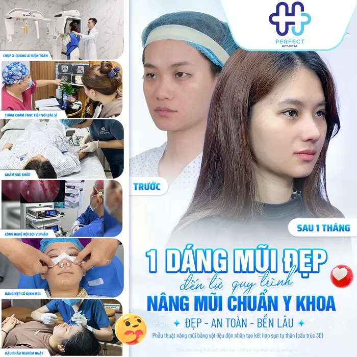 Nâng Mũi Nghỉ Dưỡng Bao Lâu? Khi Nào Có Thể Sinh Hoạt Bình Thường?