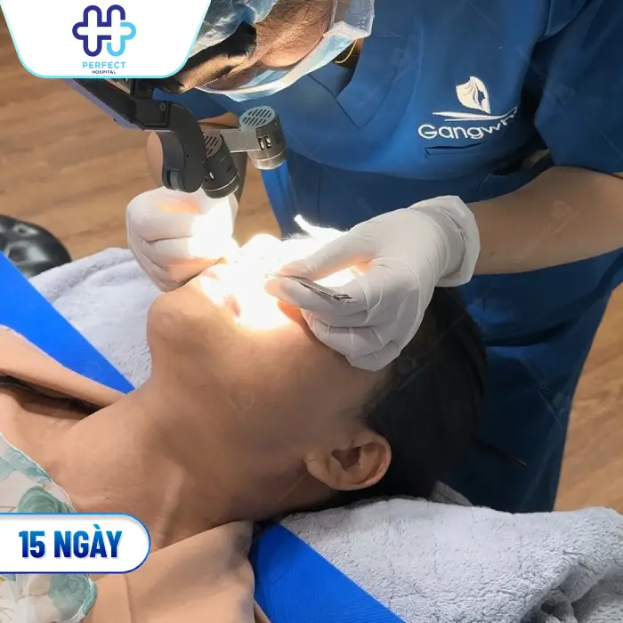 Nâng Mũi Sau 10 Ngày Đã Ổn Định Chưa? Cách Chăm Sóc Đúng