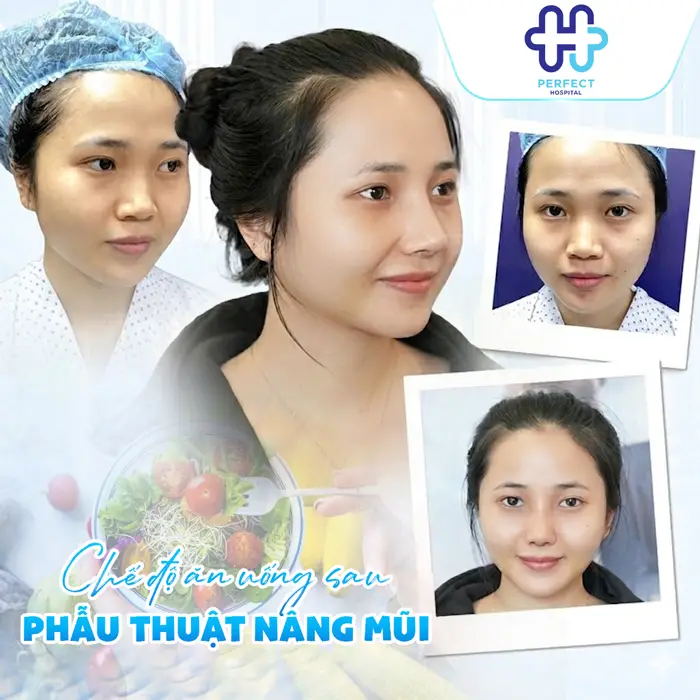 Nâng Mũi Sau 10 Ngày Đã Ổn Định Chưa? Cách Chăm Sóc Đúng