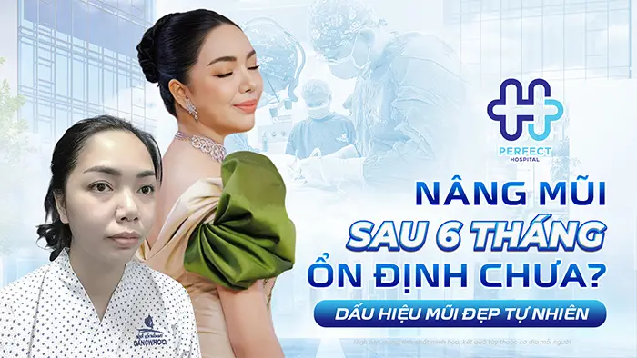 Nâng Mũi Sau 6 Tháng Ổn Định Chưa? Dấu Hiệu Mũi Đẹp Tự Nhiên