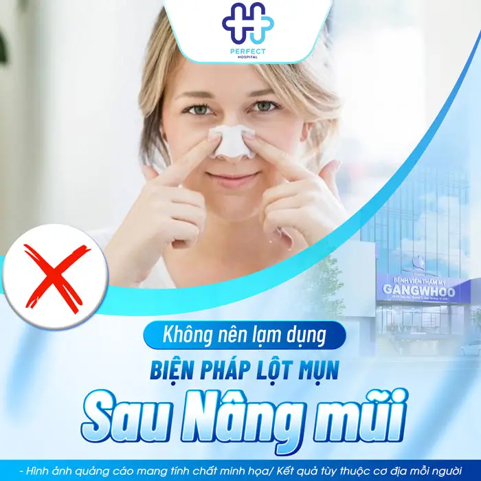 Nâng Mũi Sau Bao Lâu Thì Được Lột Mụn? Thời Điểm An Toàn