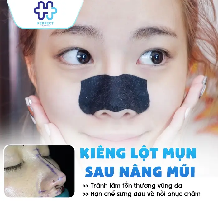 Nâng Mũi Sau Bao Lâu Thì Được Lột Mụn? Thời Điểm An Toàn
