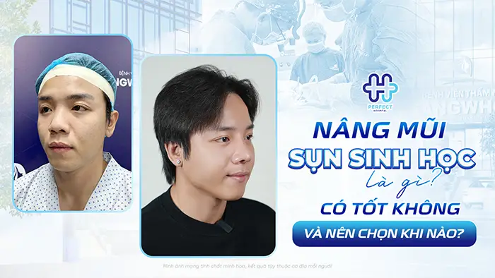 Nâng Mũi Sụn Sinh Học Là Gì? Có Tốt Không Và Nên Chọn Khi Nào?