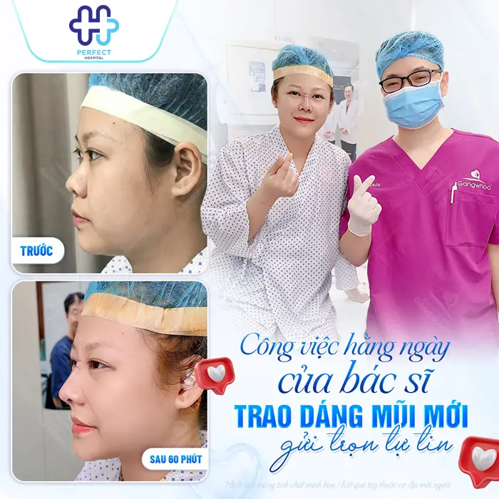Nâng Mũi Sụn Tai Có Vĩnh Viễn Không? Giải Đáp Chi Tiết