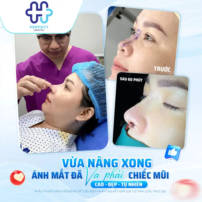 Nâng Mũi Sụn Tai Giá Bao Nhiêu? Chi Phí Mới Nhất Hiện Nay