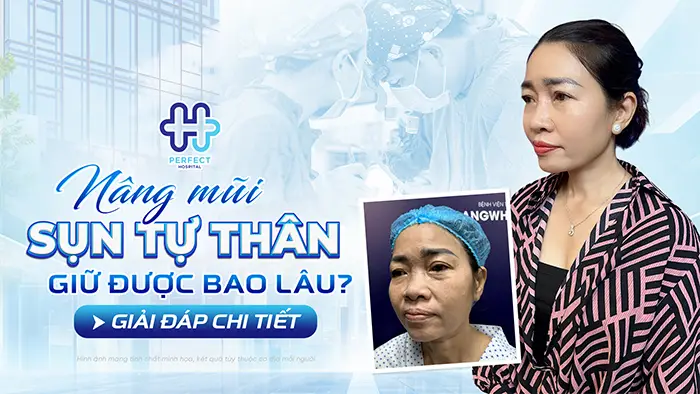 Nâng Mũi Sụn Tự Thân Giữ Được Bao Lâu? Giải Đáp Chi Tiết