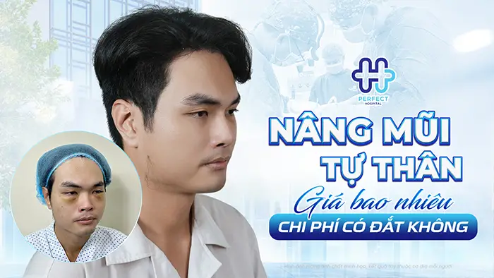 Nâng Mũi Tự Thân Giá Bao Nhiêu Và Chi Phí Có Đắt Không