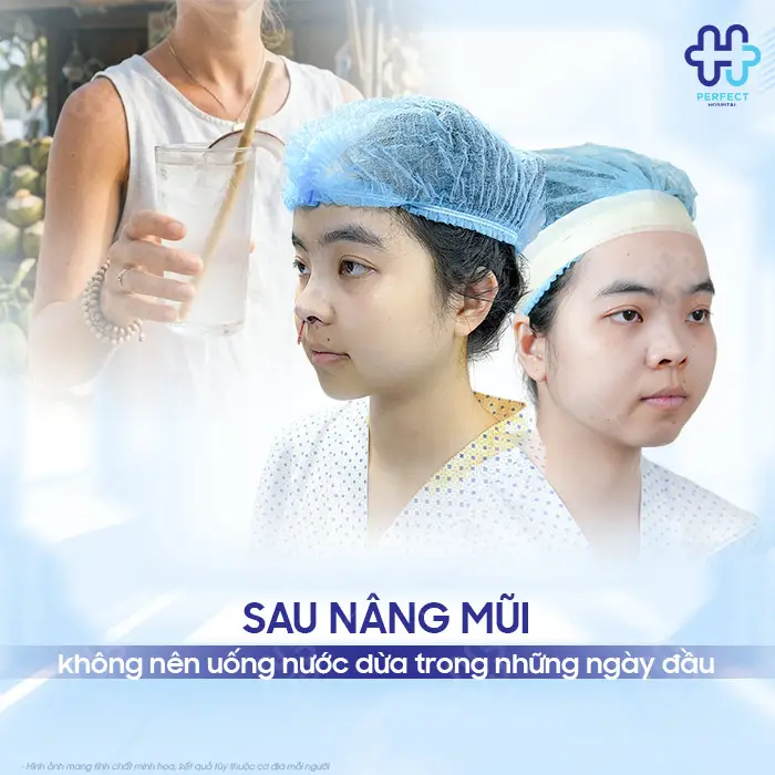 Nâng Mũi Uống Nước Dừa Được Không? Khi Nào Nên Uống Lại?