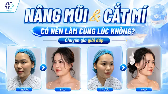 Có Nên Nâng Mũi Và Cắt Mí Mắt Cùng Lúc Không? Giải Đáp Chi Tiết