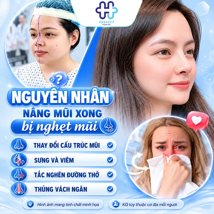 Nâng Mũi Xong Bị Nghẹt Mũi Có Nguy Hiểm Không? Cách Xử Lý Hiệu Quả