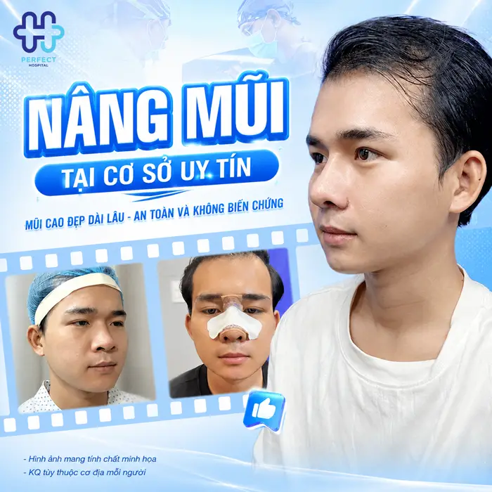 Nâng Mũi Xong Bị Nghẹt Mũi Có Nguy Hiểm Không? Cách Xử Lý Hiệu Quả