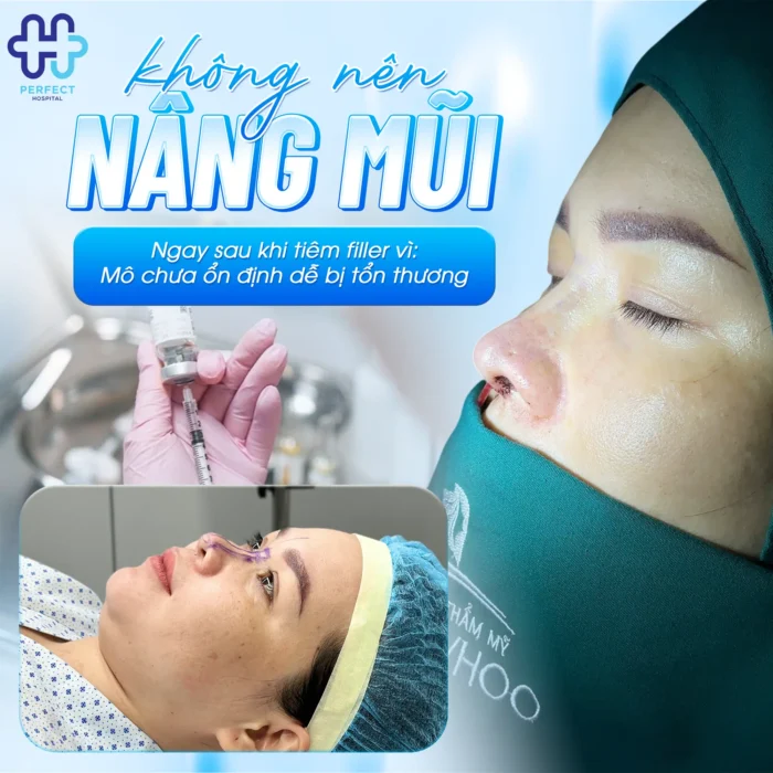 Nâng Mũi Xong Có Tiêm Filler Được Không? Lưu Ý Quan Trọng