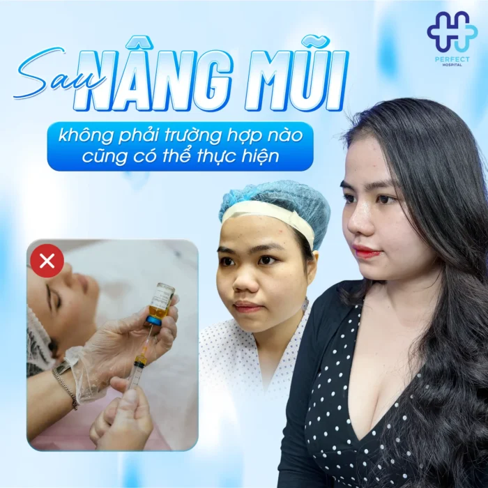 Nâng Mũi Xong Có Tiêm Filler Được Không? Lưu Ý Quan Trọng