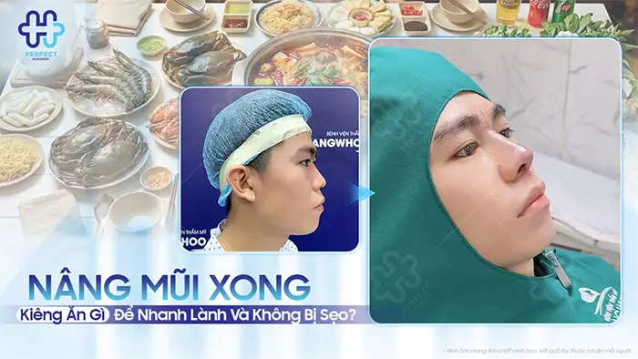 Nâng Mũi Xong Kiêng Ăn Gì Để Nhanh Lành Và Không Bị Sẹo?