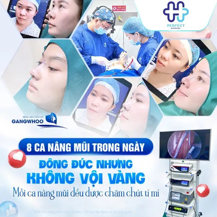 Nên Nâng Mũi Bằng Sụn Tự Thân Hay Nhân Tạo? Bác Sĩ Giải Đáp
