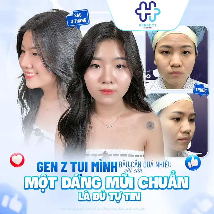 Nên Nâng Mũi Bằng Sụn Tự Thân Hay Nhân Tạo? Bác Sĩ Giải Đáp