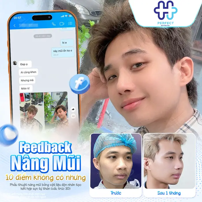 Nên Nâng Mũi S Line Hay L Line? Dáng Mũi Nào Phù Hợp Hơn?