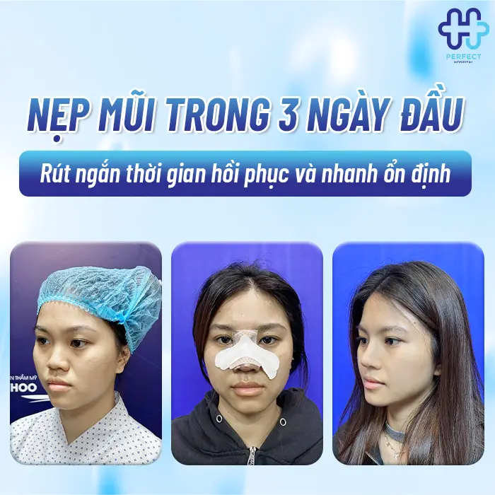 Nẹp Mũi Sau Khi Nâng Có Tác Dụng Gì? Giải Đáp Từ Perfect Hospital