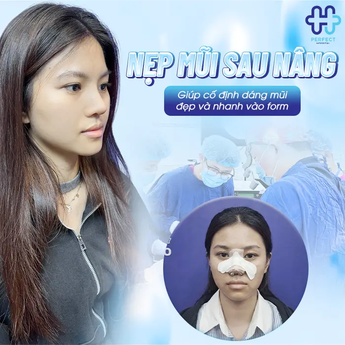 Nẹp Mũi Sau Khi Nâng Có Tác Dụng Gì? Giải Đáp Từ Perfect Hospital