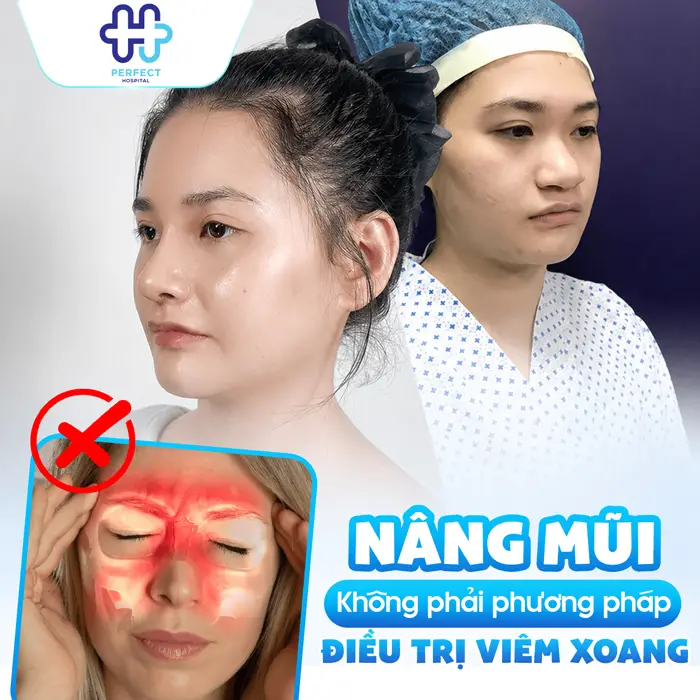 Người Bị Viêm Xoang Có Nâng Mũi Được Không Và Lưu Ý An Toàn