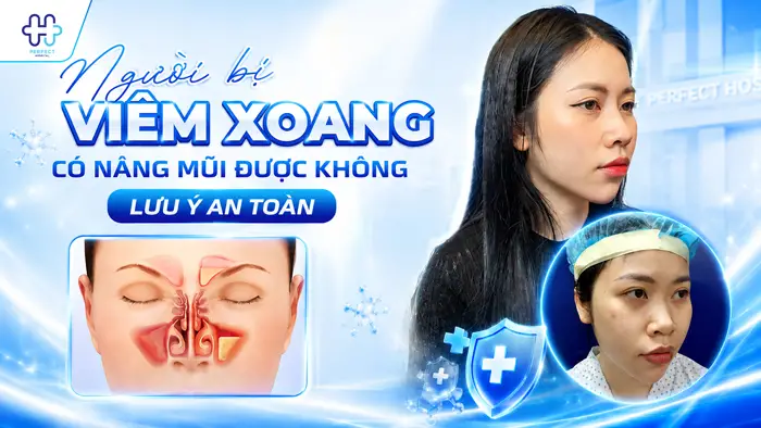 Người Bị Viêm Xoang Có Nâng Mũi Được Không Và Lưu Ý An Toàn