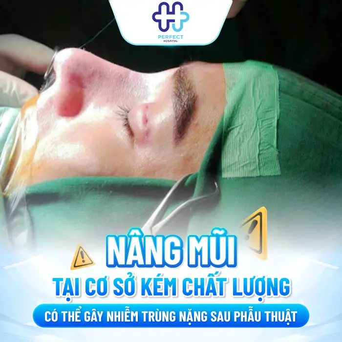 Nhiễm HIV có nâng mũi được không? Giải đáp an toàn từ chuyên gia