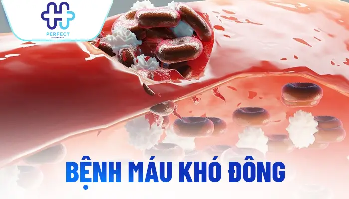 Những Trường Hợp Không Được Nâng Mũi: Những Ai Cần Cân Nhắc Kỹ?