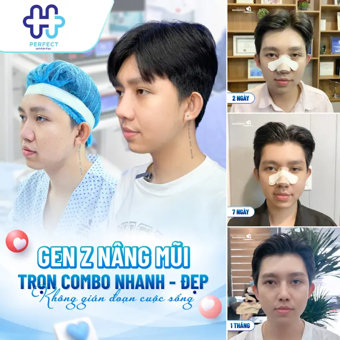 Quá Trình Phục Hồi Sau Nâng Mũi Diễn Ra Như Thế Nào? Cần Lưu Ý Gì?