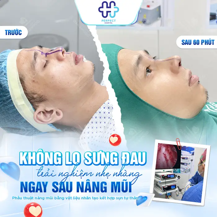 Quá Trình Phục Hồi Sau Nâng Mũi Diễn Ra Như Thế Nào? Cần Lưu Ý Gì?
