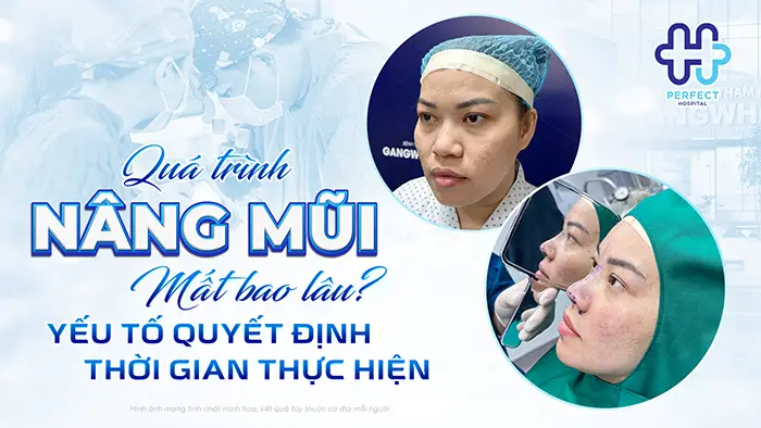 Quá Trình Nâng Mũi Mất Bao Lâu? Yếu Tố Quyết Định Thời Gian Thực Hiện