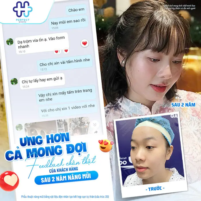 Review Nâng Mũi Tại Perfect Hospital – Ưu Điểm, Chi Phí Hợp Lý