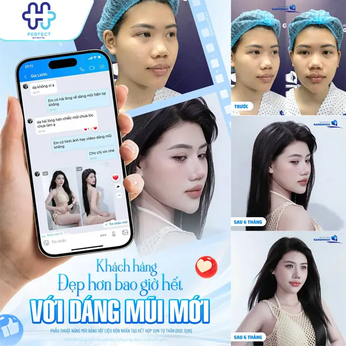 Review Nâng Mũi Tại Perfect Hospital – Ưu Điểm, Chi Phí Hợp Lý