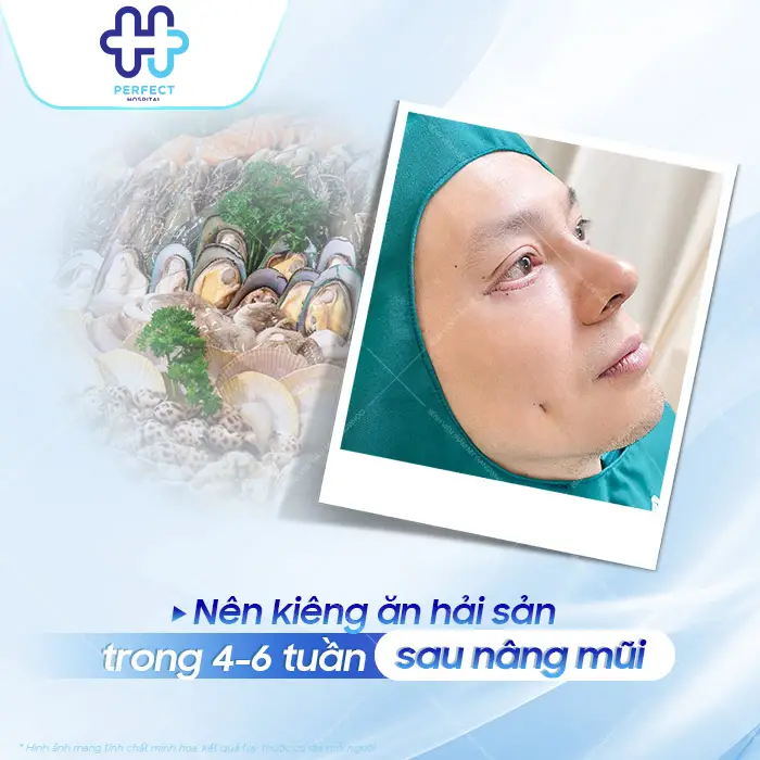 Sau Nâng Mũi Kiêng Ăn Hải Sản Bao Lâu Và Khi Nào Ăn Lại An Toàn