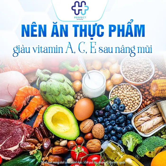 Sau Nâng Mũi Kiêng Ăn Hải Sản Bao Lâu Và Khi Nào Ăn Lại An Toàn