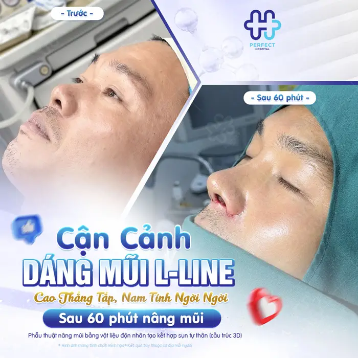 Serum Nâng Mũi Có Hiệu Quả Không? Sự Thật Bạn Cần Biết