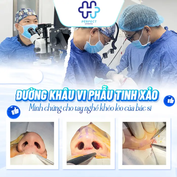 Sụn Nâng Mũi 3D Hàn Quốc Là Gì? Có Tốt Và An Toàn Không