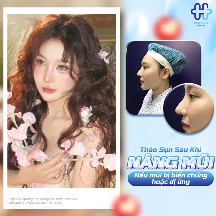 Tháo Sụn Sau Khi Nâng Mũi Có Nguy Hiểm Không Và Khi Nào Nên Thực Hiện