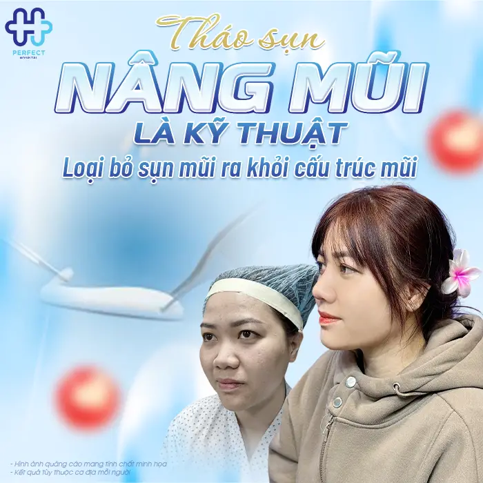 Tháo Sụn Sau Khi Nâng Mũi Có Nguy Hiểm Không Và Khi Nào Nên Thực Hiện