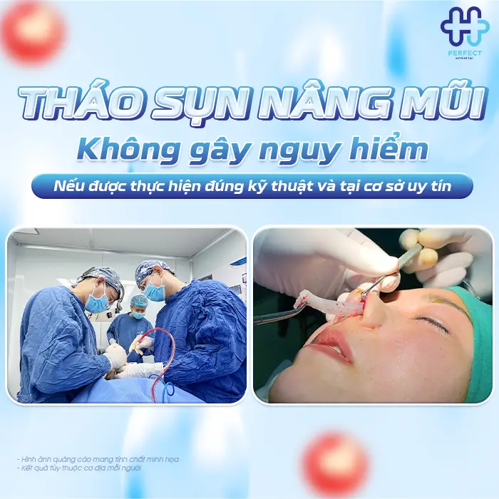 Tháo Sụn Sau Khi Nâng Mũi Có Nguy Hiểm Không Và Khi Nào Nên Thực Hiện