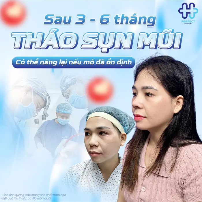 Tháo Sụn Sau Khi Nâng Mũi Có Nguy Hiểm Không Và Khi Nào Nên Thực Hiện