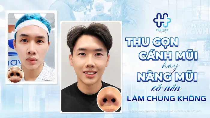 Thu Gọn Cánh Mũi Và Nâng Mũi Có Nên Làm Chung Không?