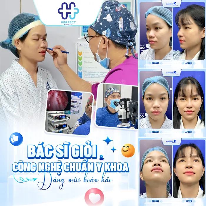 Thu Gọn Cánh Mũi Và Nâng Mũi Có Nên Làm Chung Không?