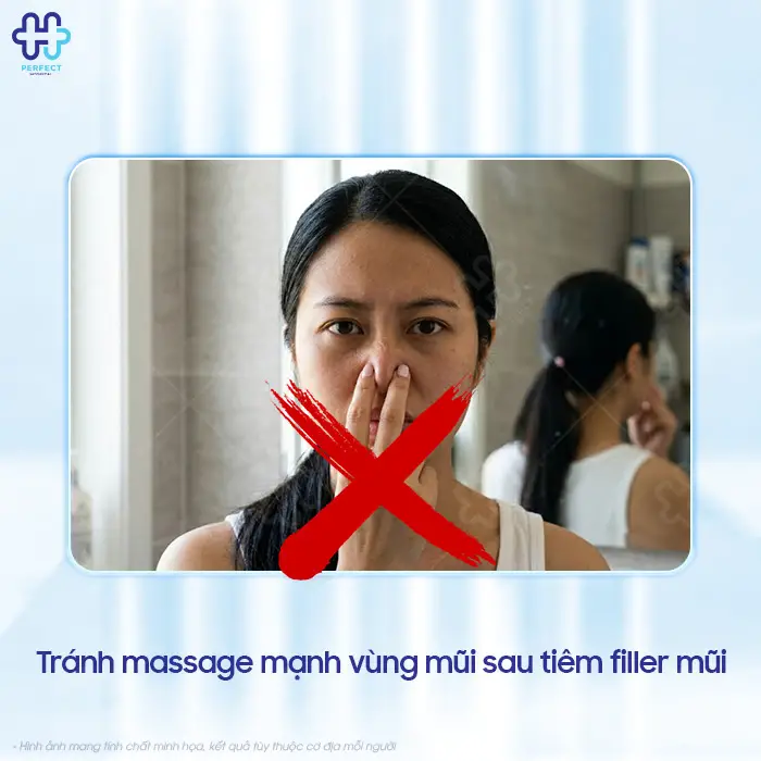 Tiêm nâng mũi bằng filler là gì? Có nên lựa chọn phương pháp này?